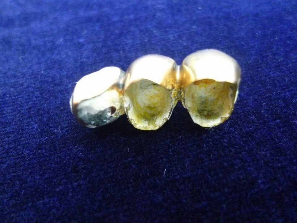 「金歯も立派な金製品　意外とイイ金額になります　沼津市の金のクマ」　銀歯も買い取り大歓迎です