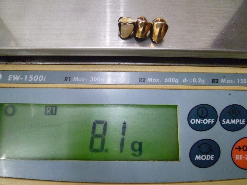 「金歯も立派な金製品　意外とイイ金額になります　沼津市の金のクマ」　銀歯も買い取り大歓迎です