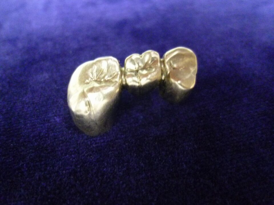 「金歯だけじゃなく銀歯の買い取りも大歓迎です　沼津市の金のクマ」　歯が付いたままでも大丈夫です