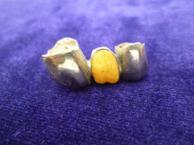 「金歯だけじゃなく銀歯の買い取りも大歓迎です　沼津市の金のクマ」　歯が付いたままでも大丈夫です