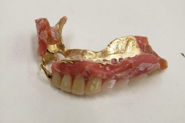 「金歯だけじゃなく入れ歯も金を使ったものがあります　沼津の金のクマ」金歯よりもはるかに重い物あり