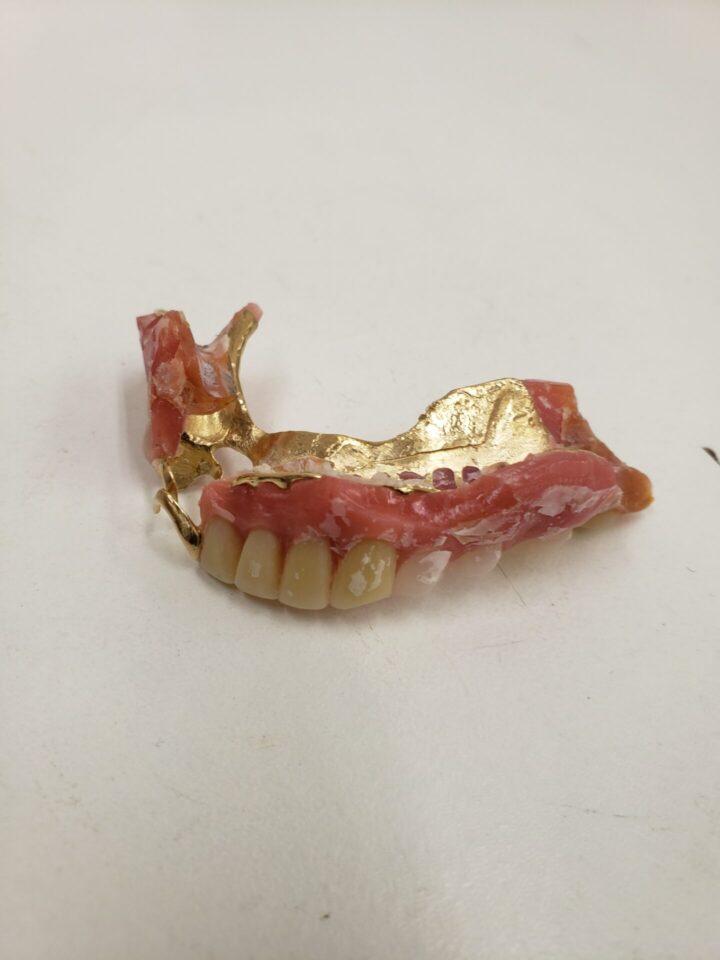 「金歯だけじゃなく入れ歯も金を使ったものがあります　沼津の金のクマ」金歯よりもはるかに重い物あり