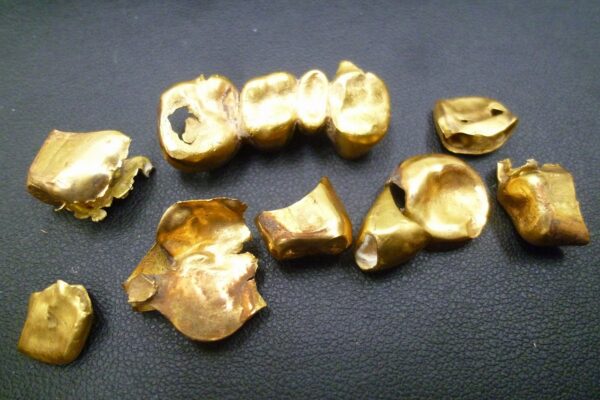 「金歯も立派な金製品　まとめてお買い取りです♪　沼津の金のクマ」　金歯も銀歯も買い取り大歓迎です