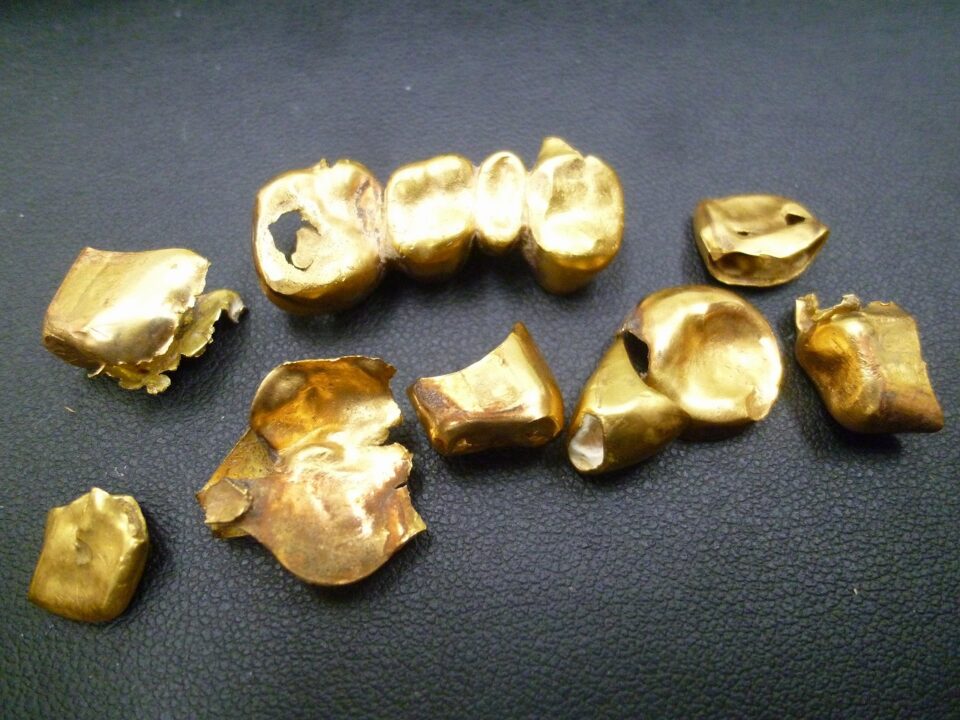 「金歯も立派な金製品　まとめてお買い取りです♪　沼津の金のクマ」　金歯も銀歯も買い取り大歓迎です