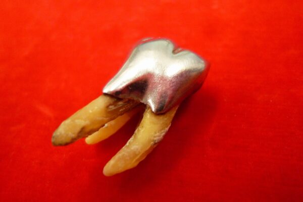 「銀歯の買い取りも大歓迎です　沼津の金のクマ」　買い取り可能なのは金歯だけではないです(^O^)