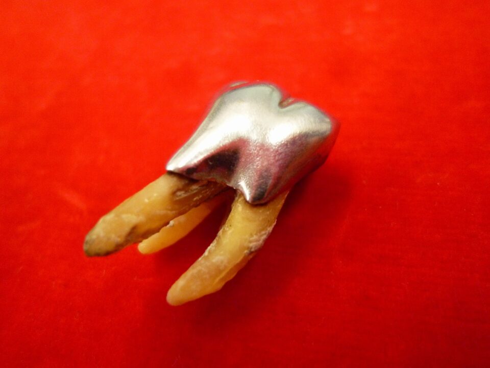 「銀歯の買い取りも大歓迎です　沼津の金のクマ」　買い取り可能なのは金歯だけではないです(^O^)