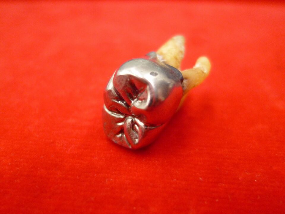 「銀歯の買い取りも大歓迎です　沼津の金のクマ」　買い取り可能なのは金歯だけではないです(^O^)